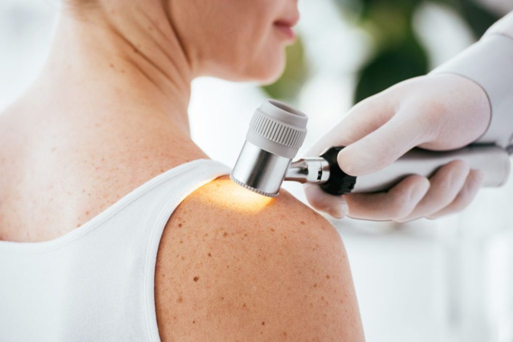 Neste artigo, discutimos alguns desses tratamentos que têm se mostrado eficazes no combate ao melanoma.